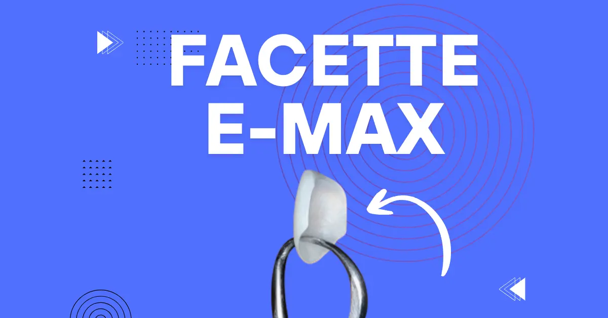 Facette dentaire E-max - Laboratoire Dentaire Marrakech