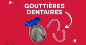 gouttière