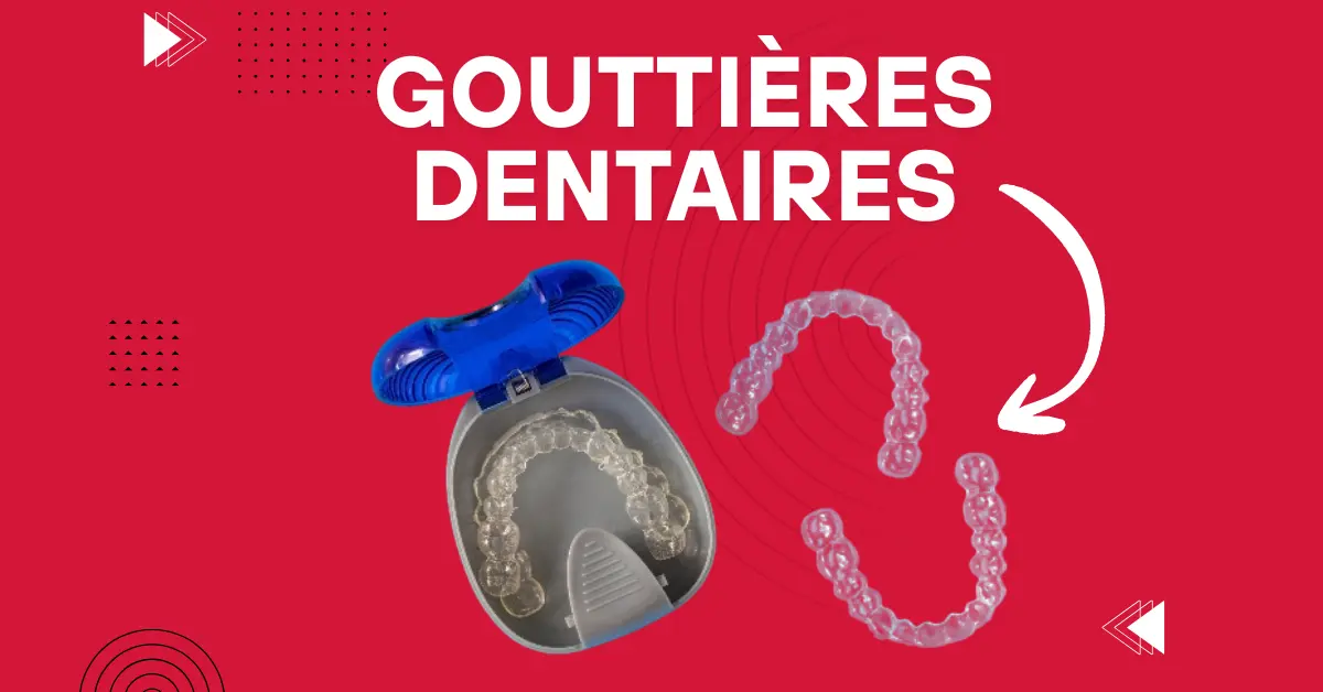 Gouttières dentaires sur mesure - Laboratoire Dentaire Marrakech