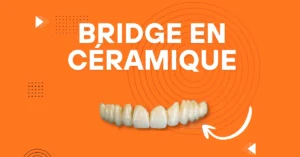 bridge dentaire