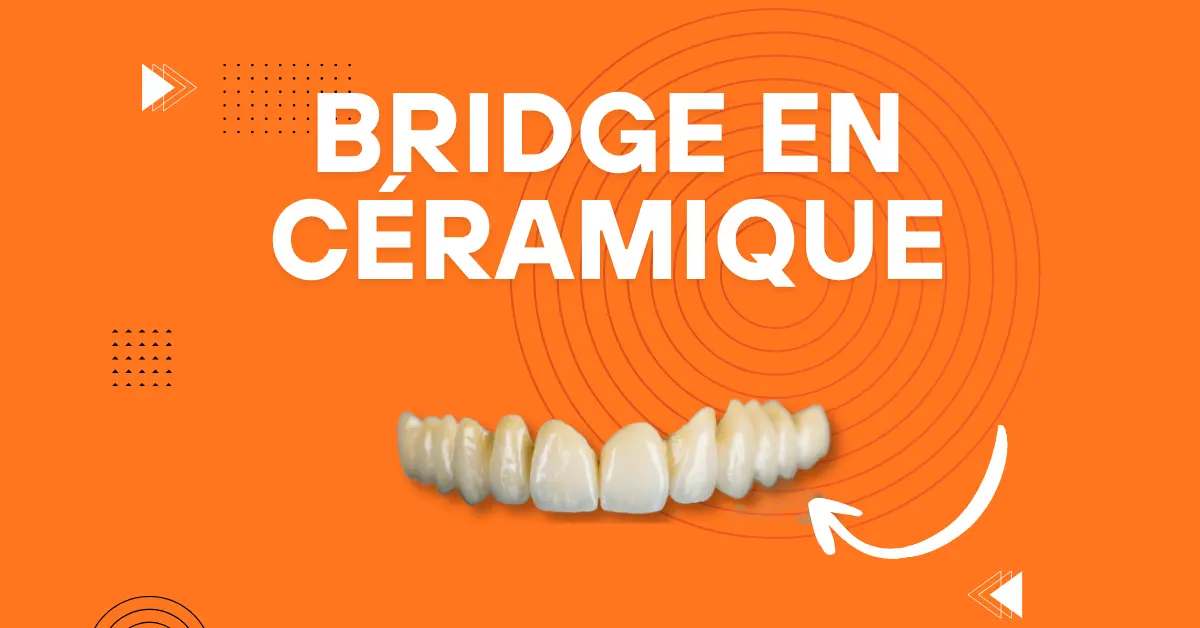 Denture dentaire - Laboratoire Dentaire Marrakech