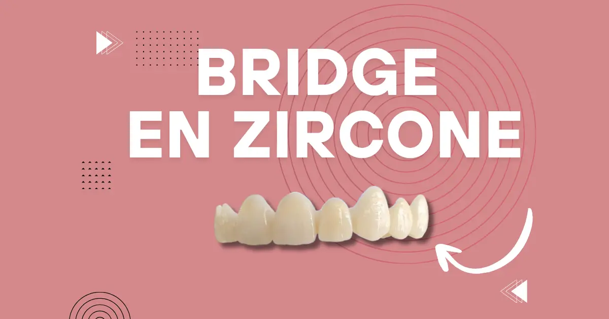 Bridge dentaire en zircone - Laboratoire Dentaire Marrakech