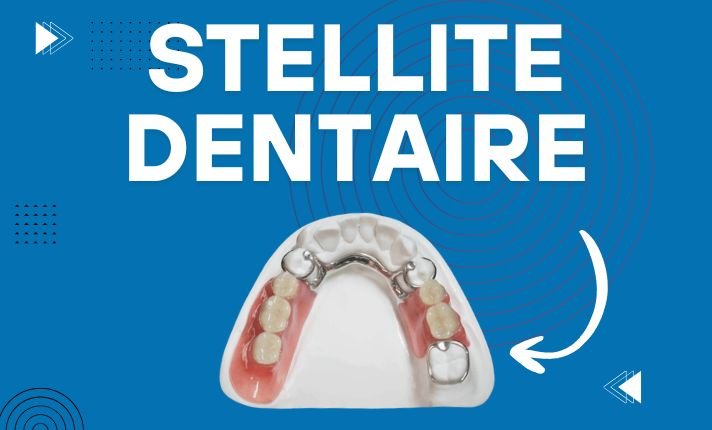 Prothèse en Stellite