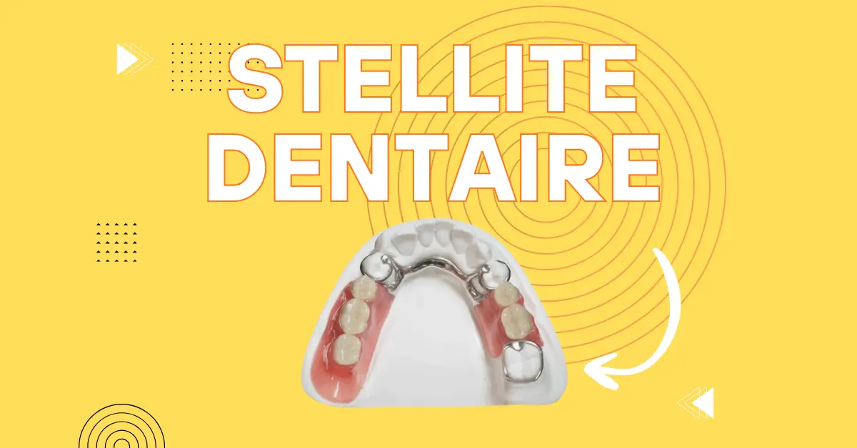 Prothèse dentaire en Stellite - Laboratoire Dentaire Marrakech