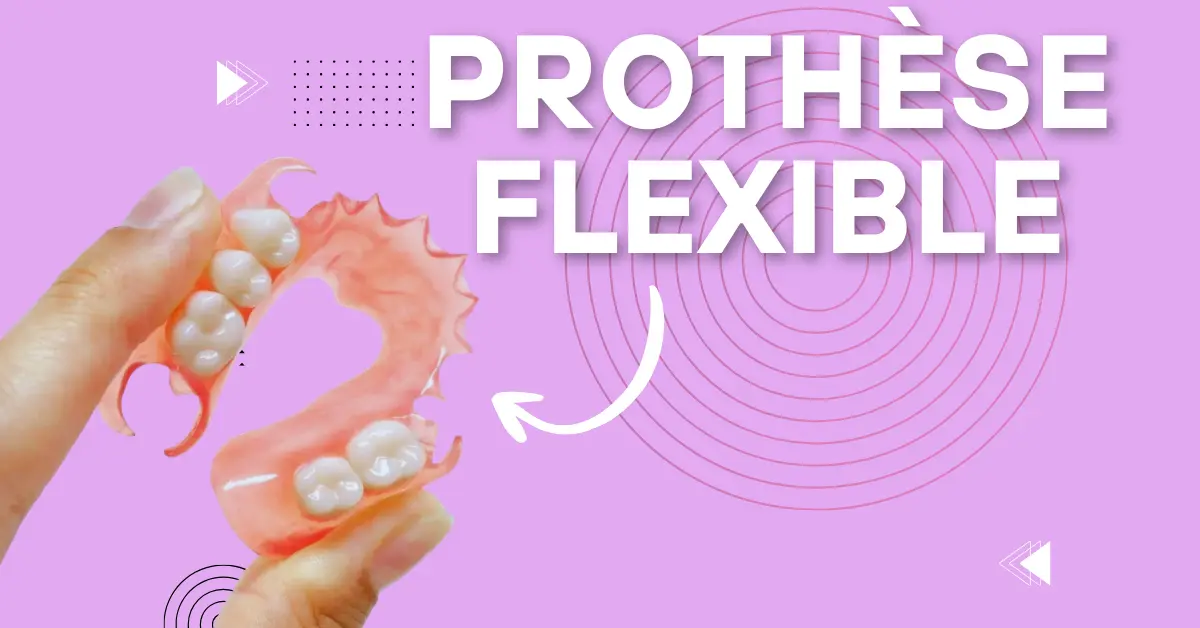 Prothèse dentaire flexible - Laboratoire Dentaire Marrakech
