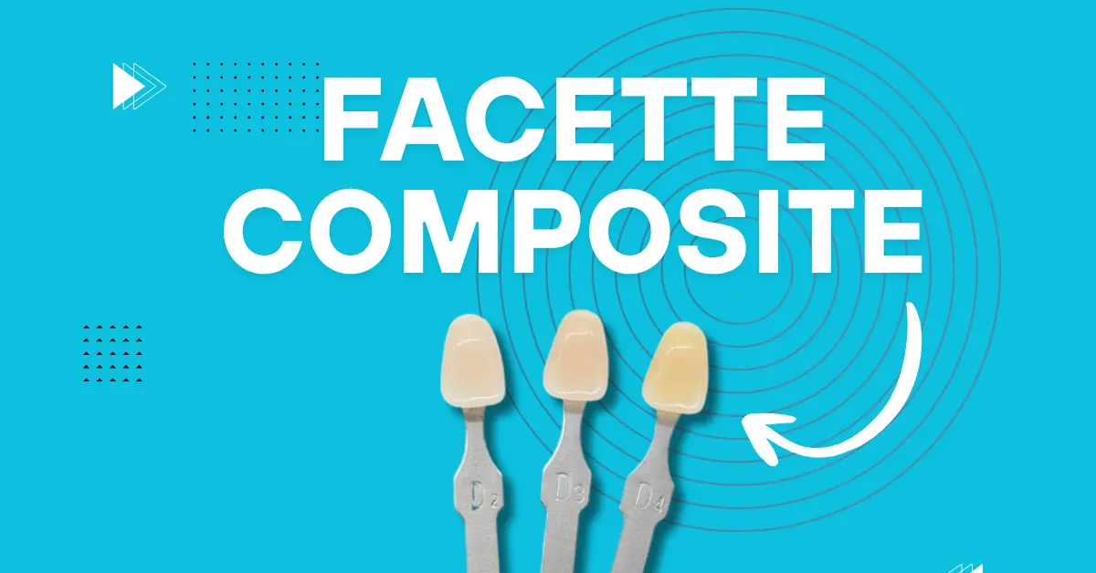 Facette dentaire en composite - Laboratoire Dentaire Marrakech