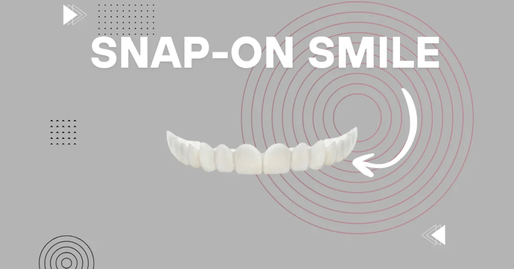 Snap on Smile