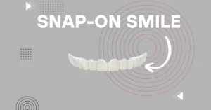 Snap on Smile