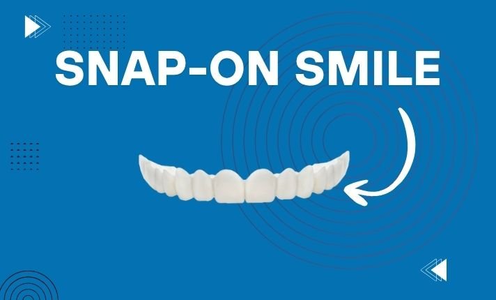 Snap-On Smile