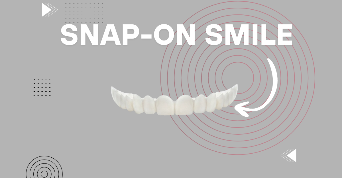 Snap-On Smile sur mesure - Laboratoire Dentaire Marrakech