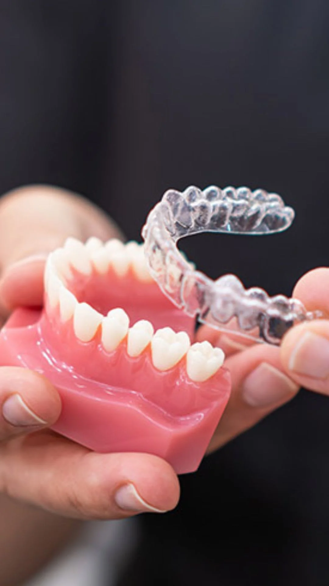 Gouttières dentaires sur mesure